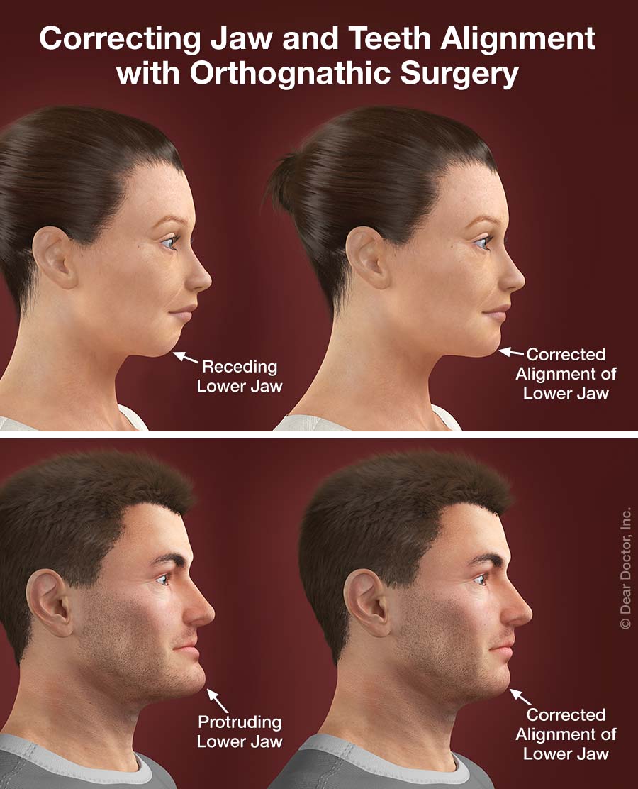 Orthodontics and surgery.